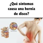 Ciática: Identificando los Síntomas de una Hernia Discal