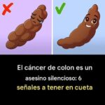 El Cáncer de Colon: 6 Señales de Advertencia que No Debes Ignorar