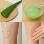 Dile Adiós a las Varices y la Pesadez de Piernas con Aloe Vera: Receta Natural