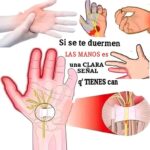 Entumecimiento de Manos: Causas, Síntomas y Remedios Naturales