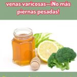 Alivio Natural para Venas Varicosas: Receta Efectiva