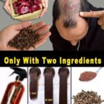 Receta Natural para el Crecimiento del Cabello: Cebolla Roja y Clavos de Olor