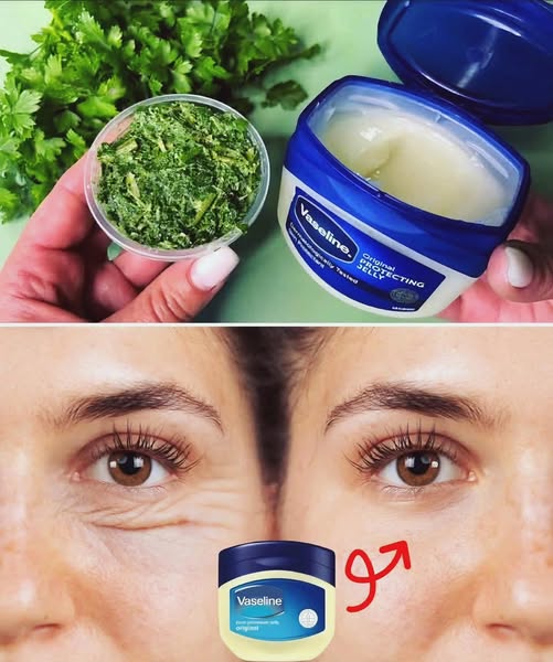 Remedio casero de Vaselina y Perejil
