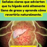 Hígado Graso: Señales y Cómo Revertirlo de Forma Natural