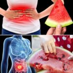 Limpia tu intestino, hígado y riñones en solo 3 días con sandía