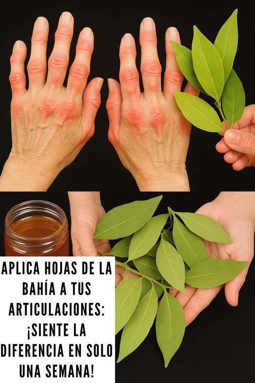 Aplicación de hojas de la bahía para articulaciones
