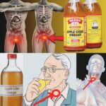 Los increíbles beneficios del vinagre de sidra de manzana para la salud