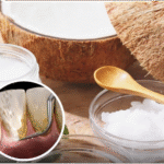 Aceite con Coco: El Secreto Natural para una Salud Bucal Radiante